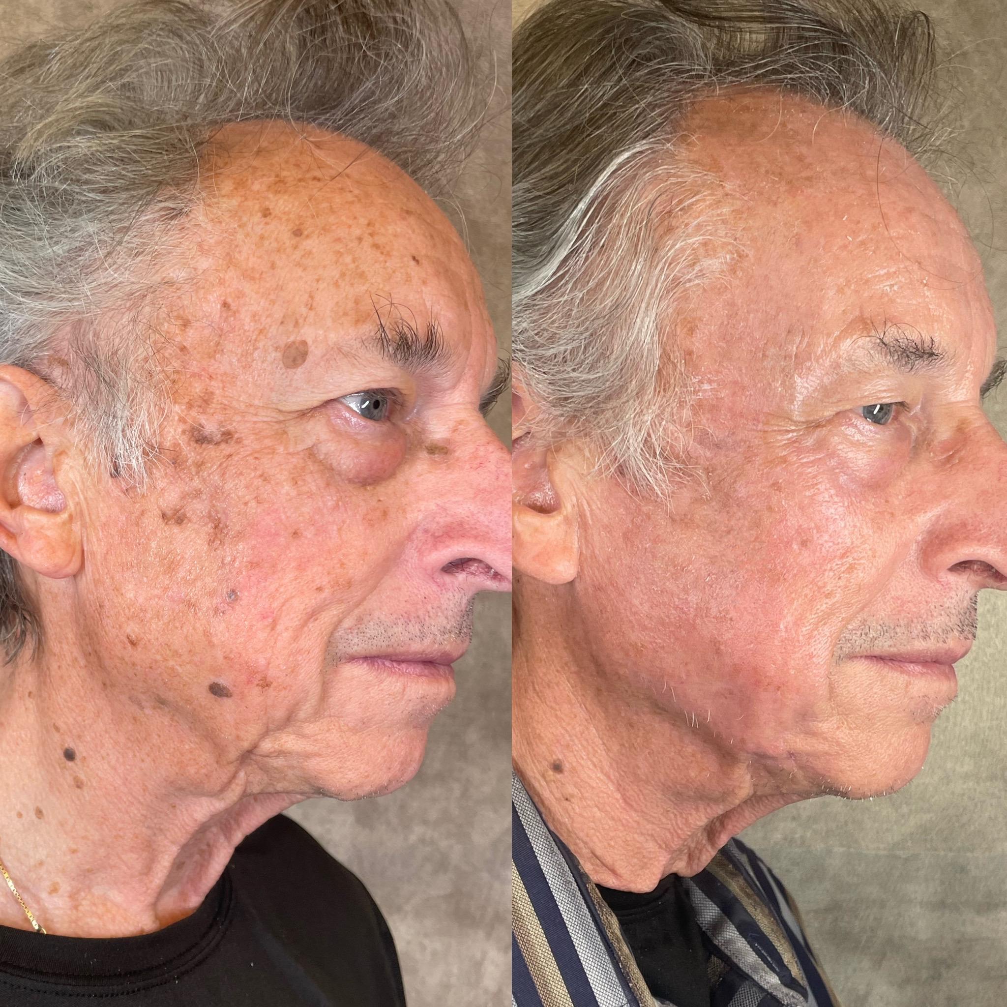 Treatment result photo