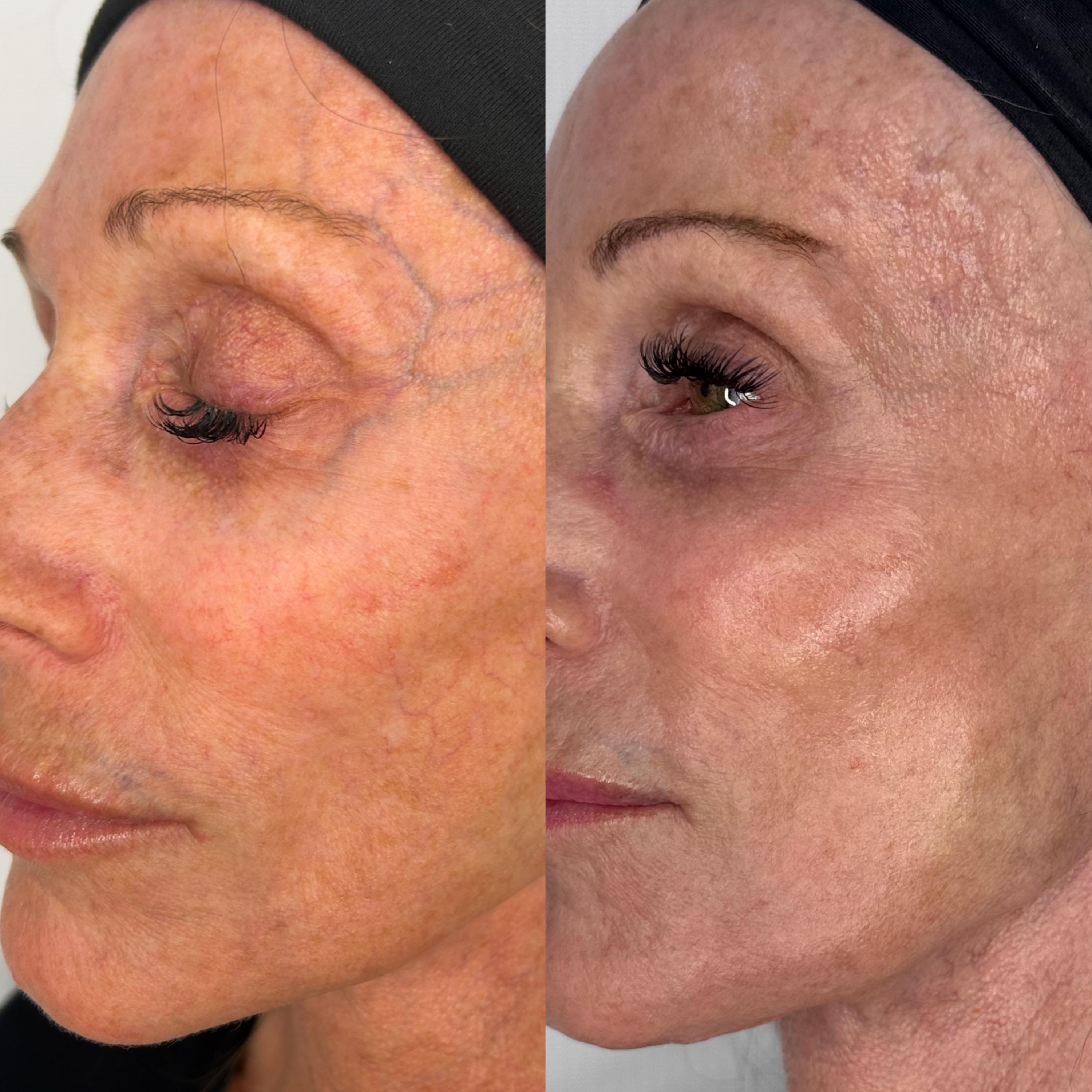 Treatment result photo