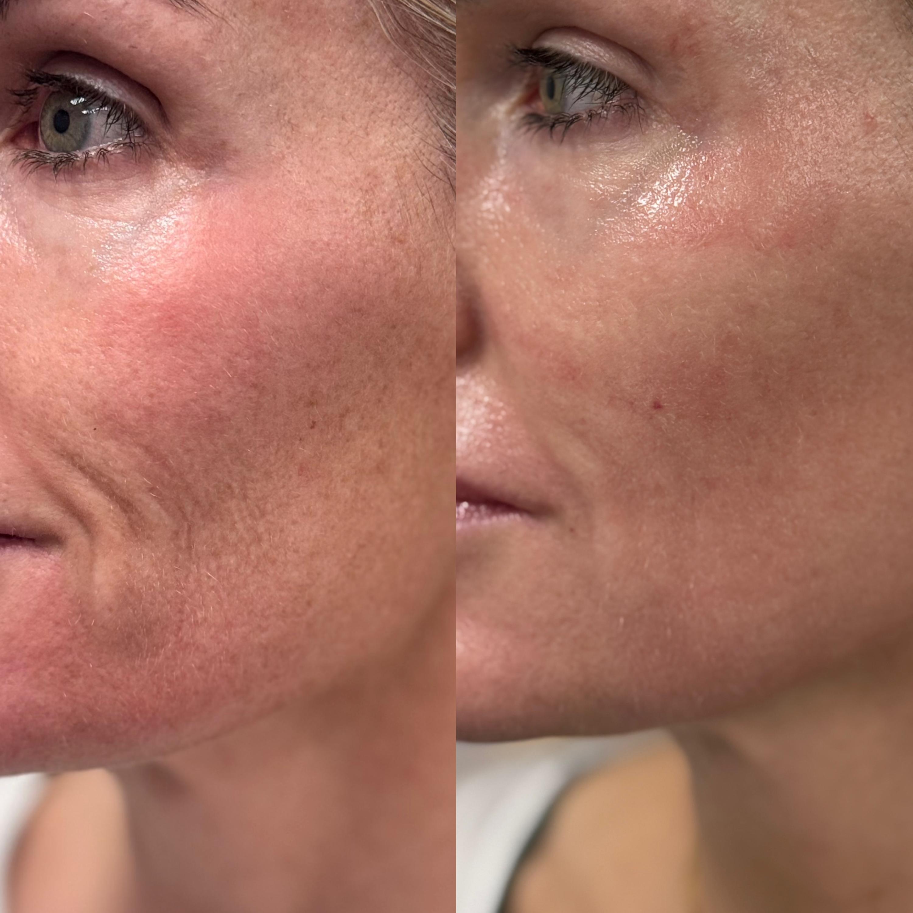 Treatment result photo