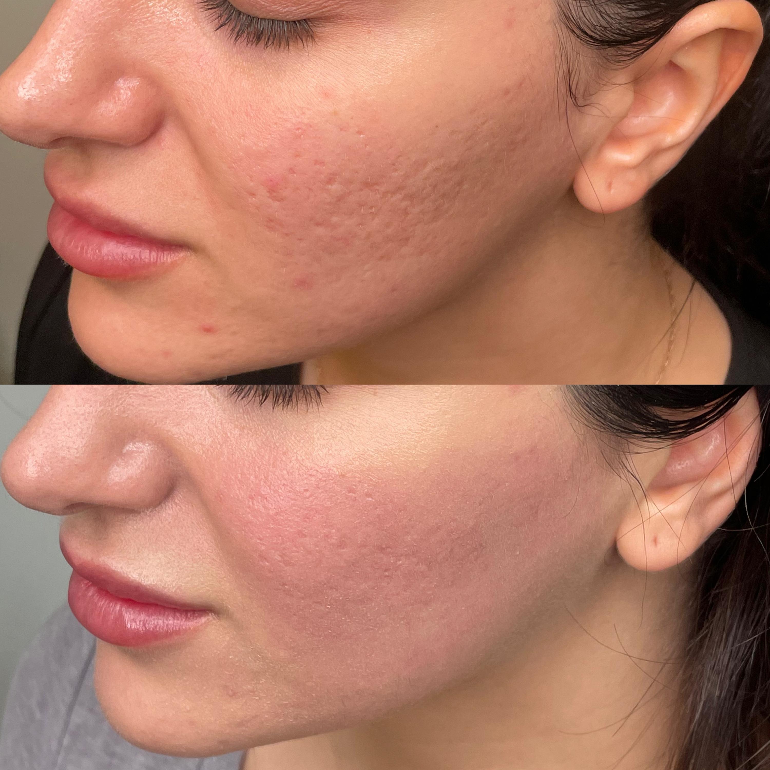 Treatment result photo