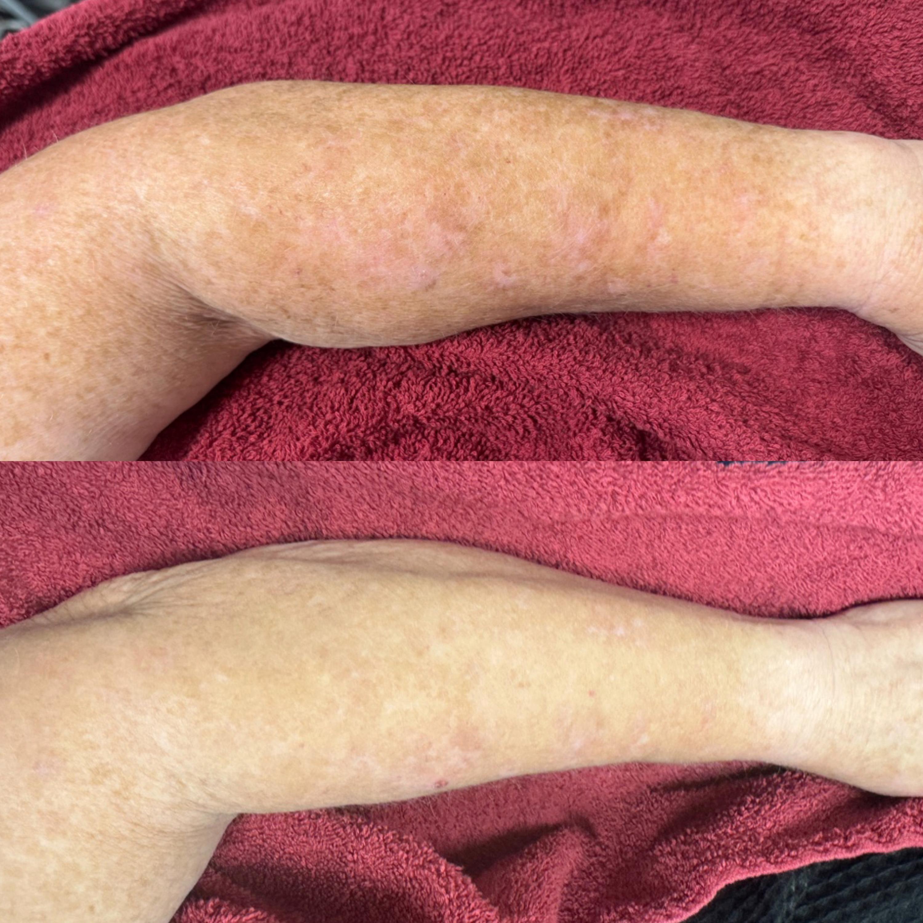 Treatment result photo