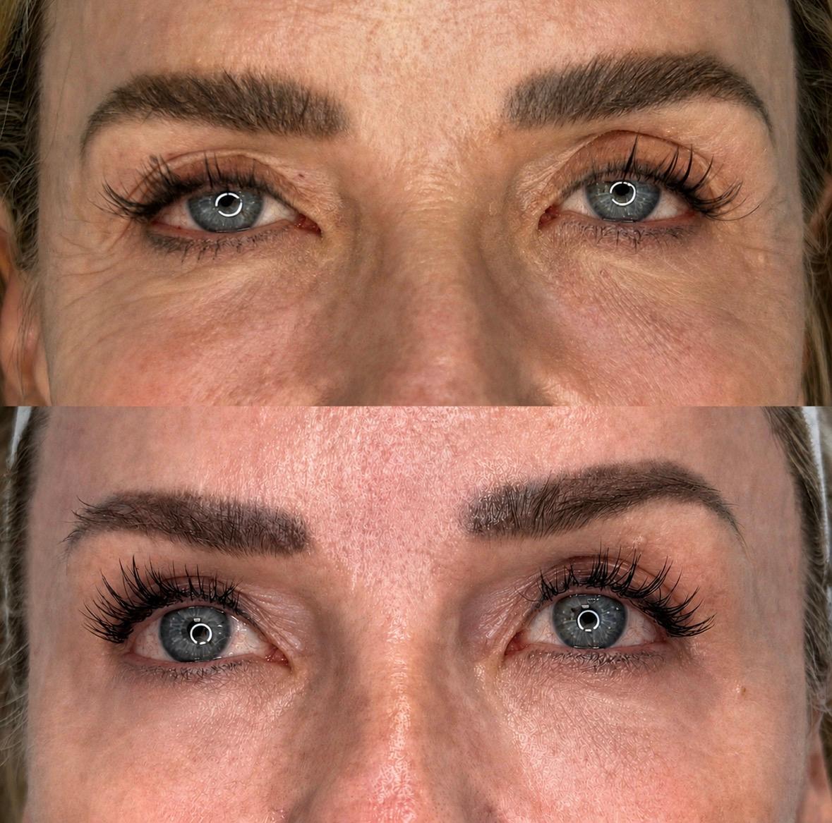 Treatment result photo