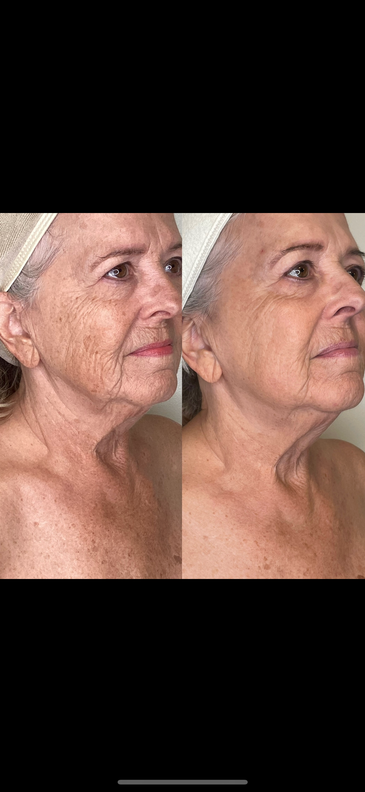 Treatment result photo