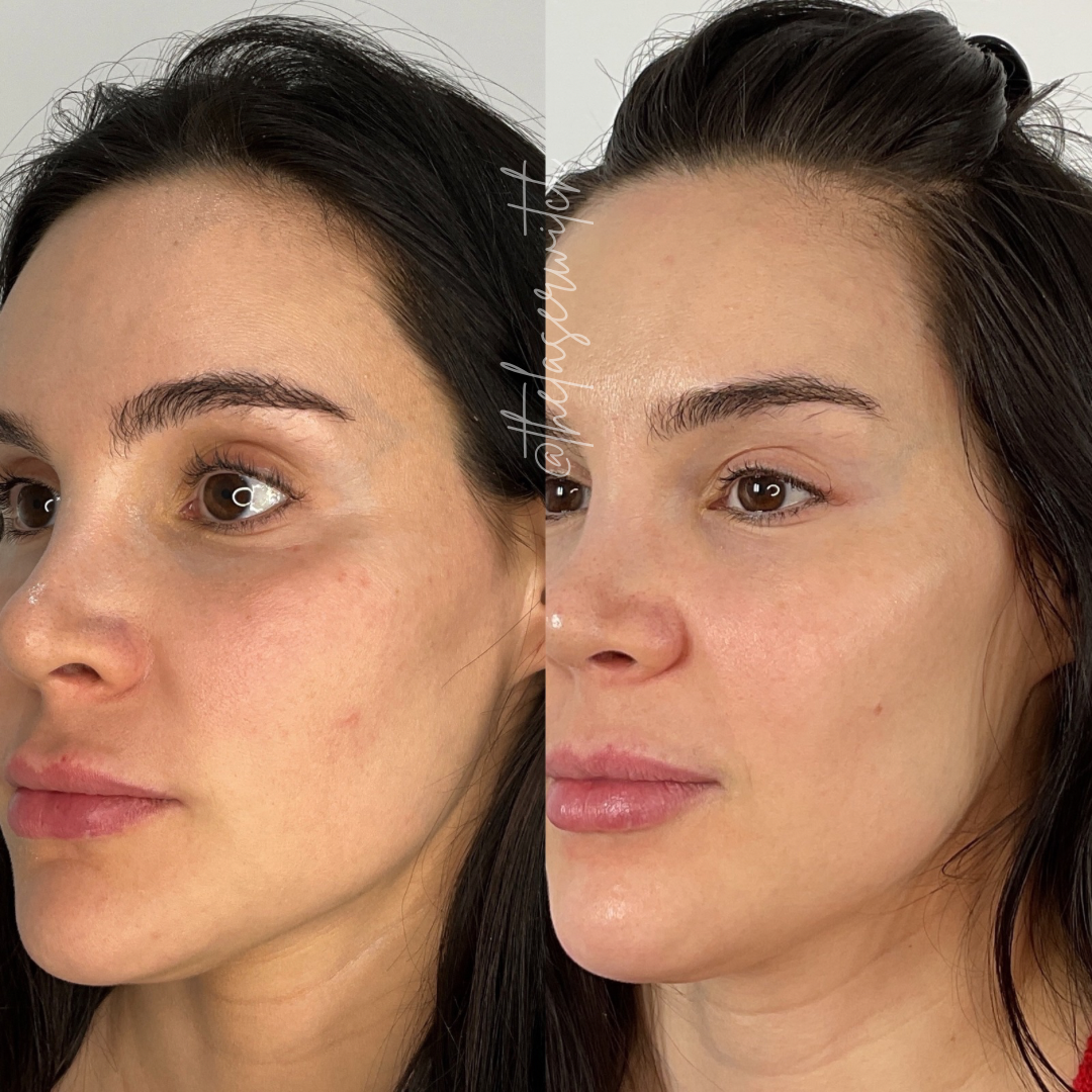 Treatment result photo