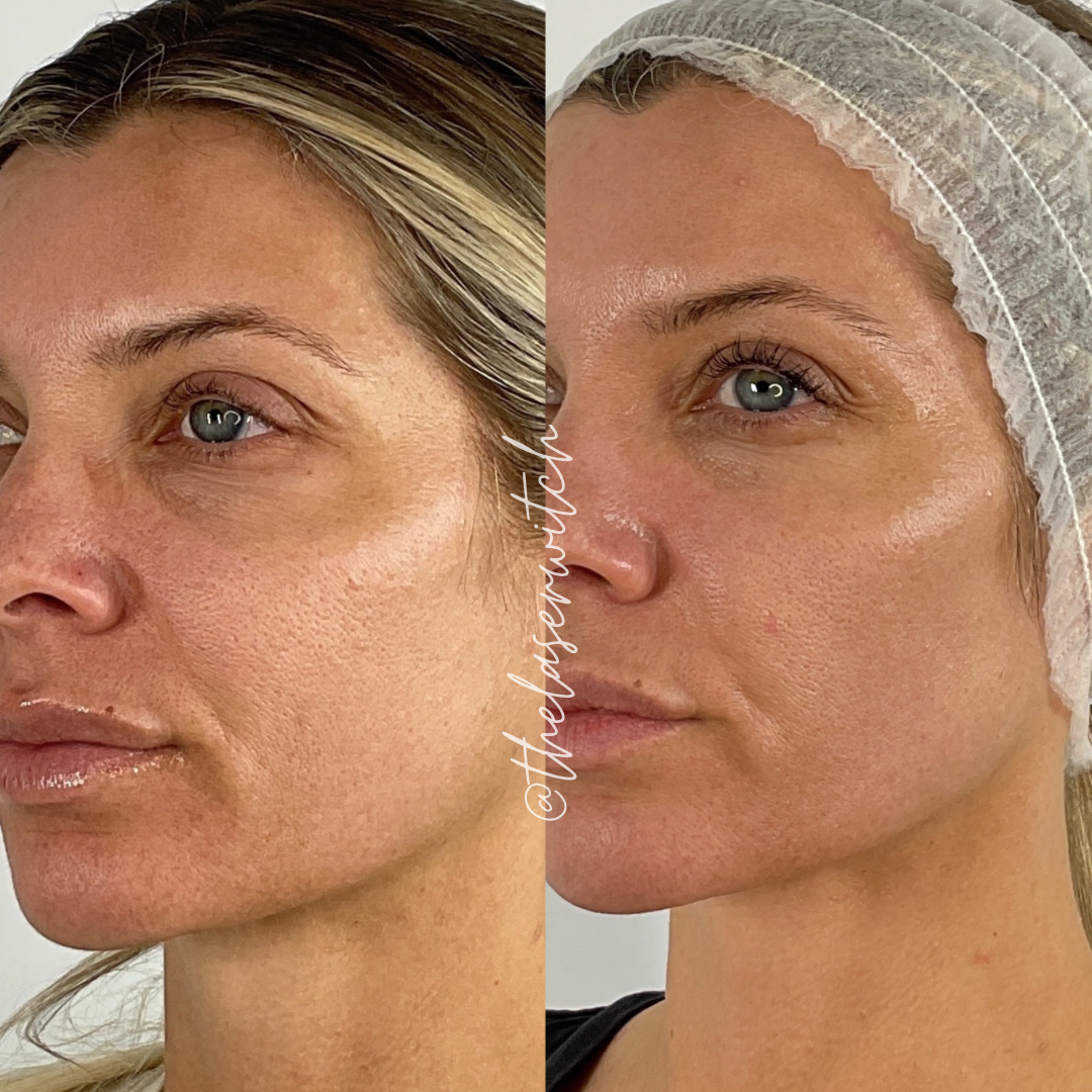 Treatment result photo