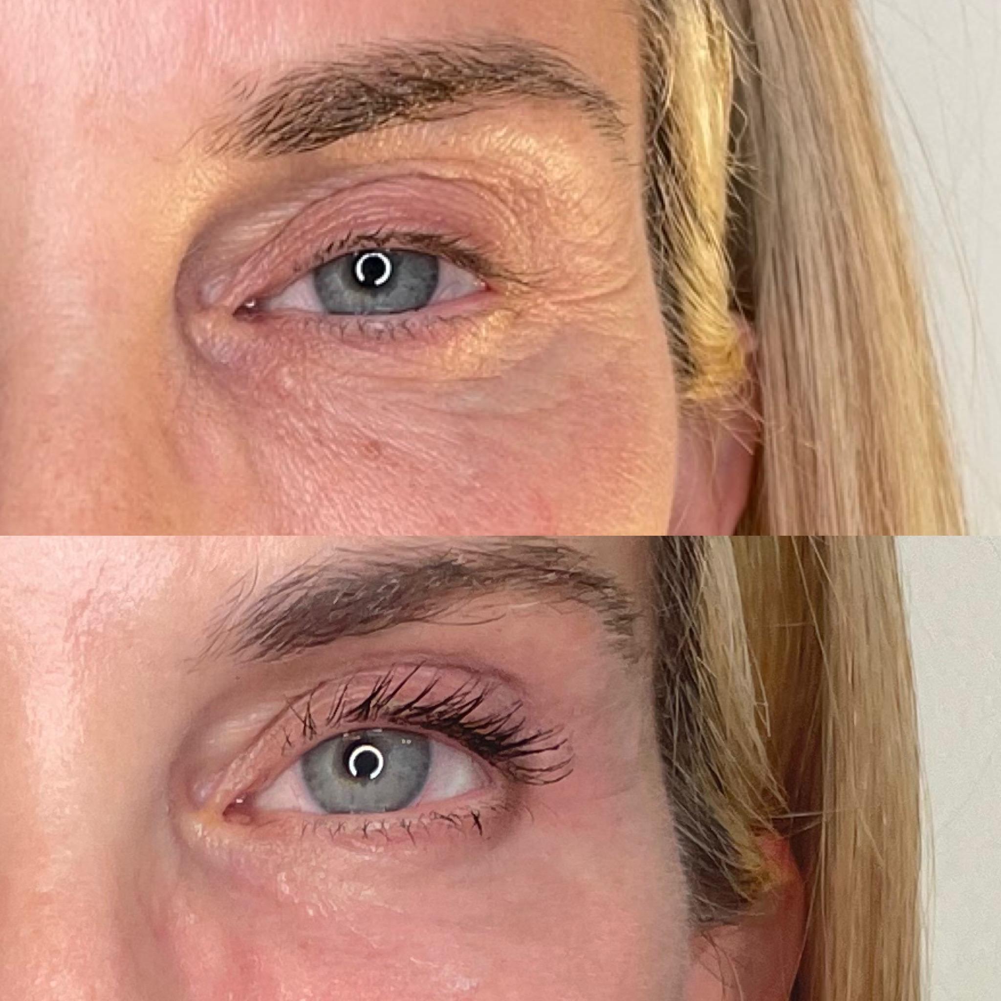 Treatment result photo