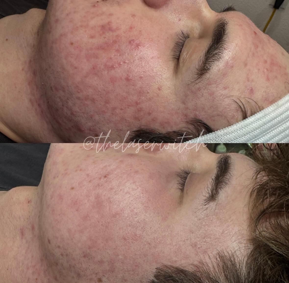 Treatment result photo