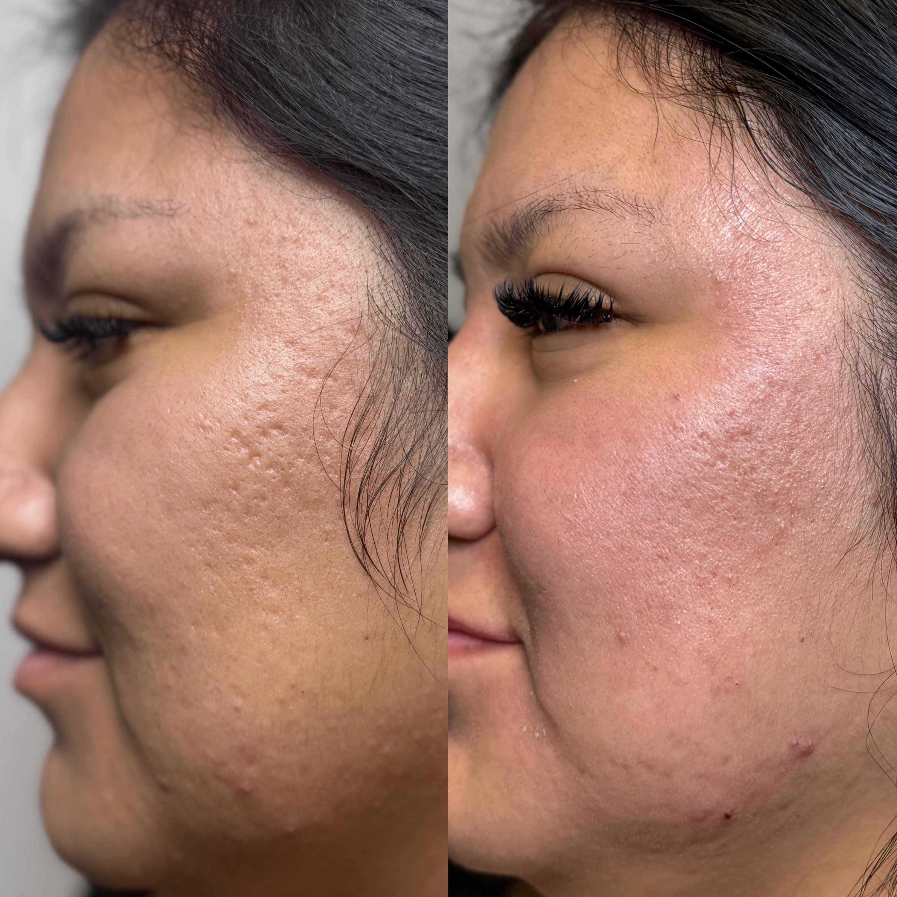 Treatment result photo