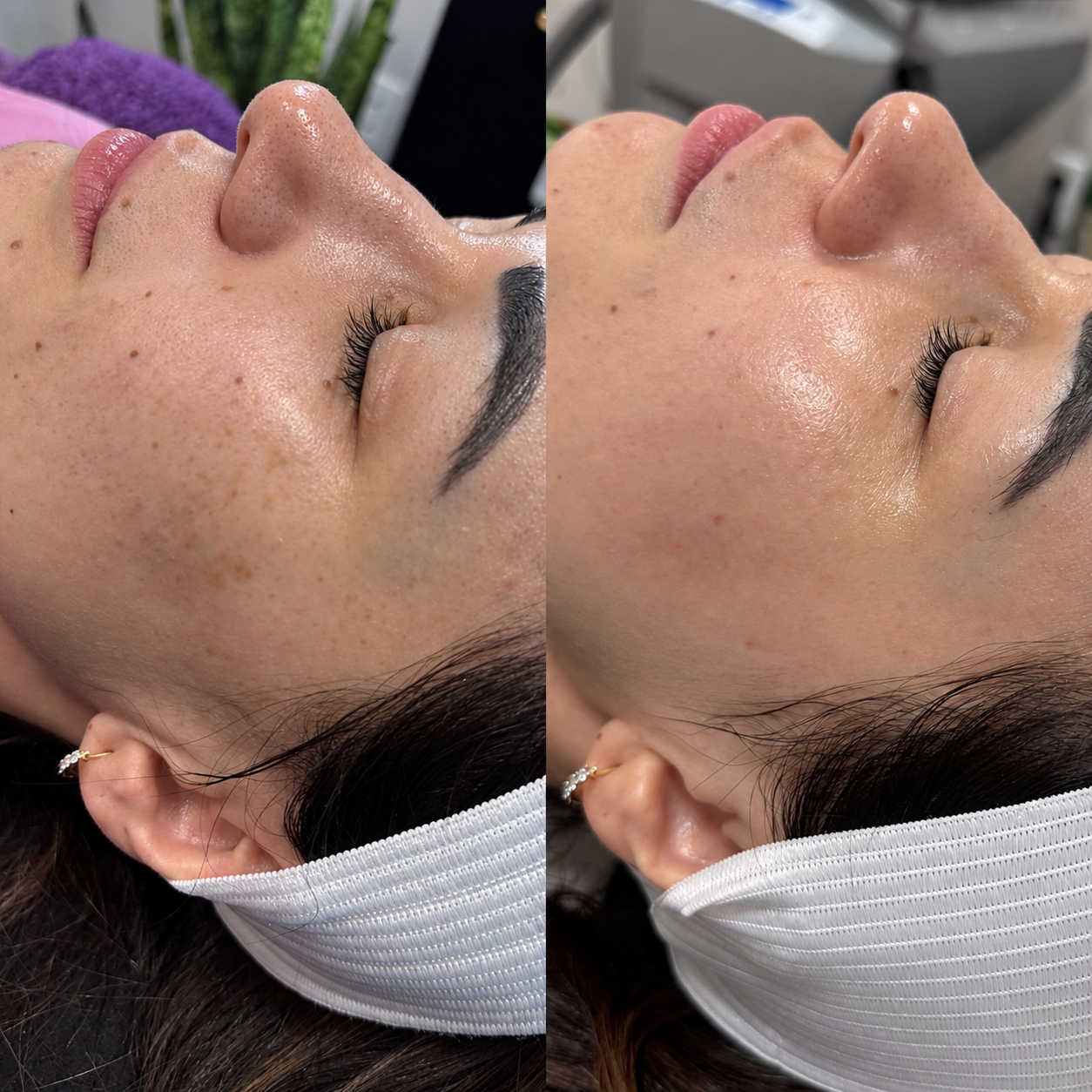 Treatment result photo