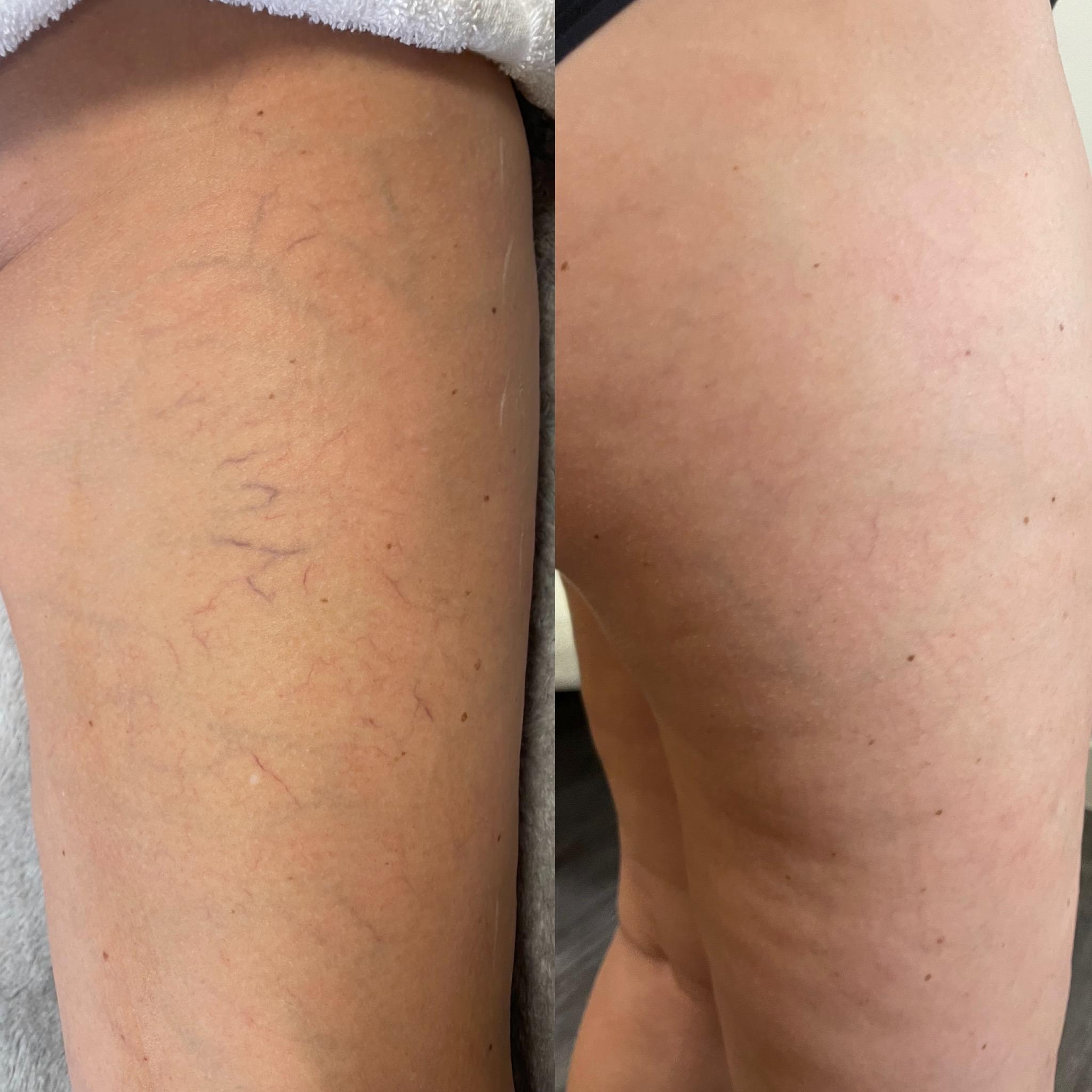 Treatment result photo