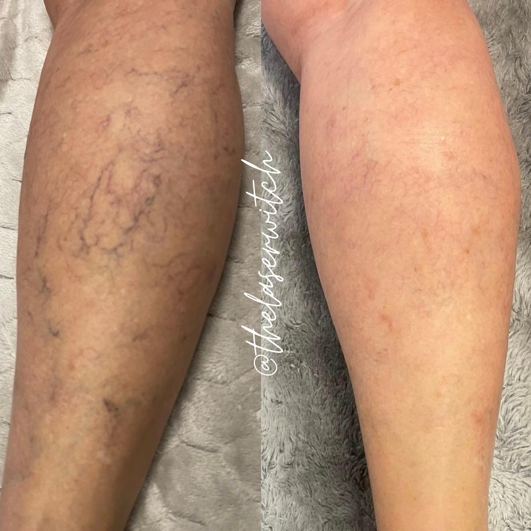 Treatment result photo