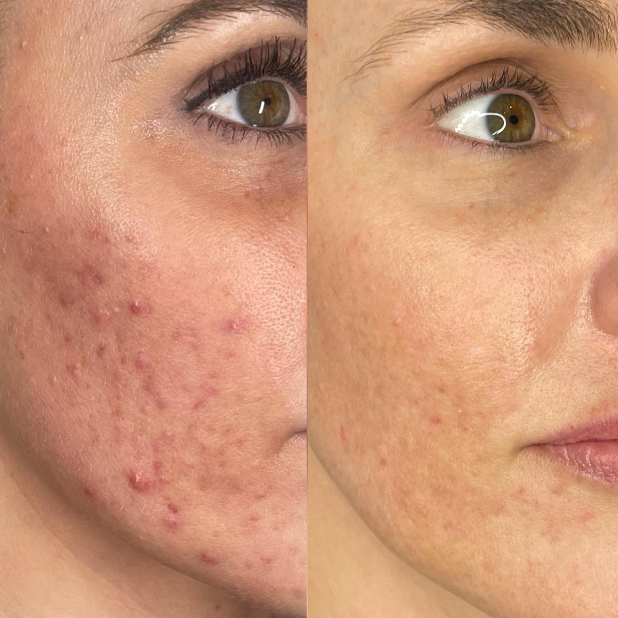 Treatment result photo