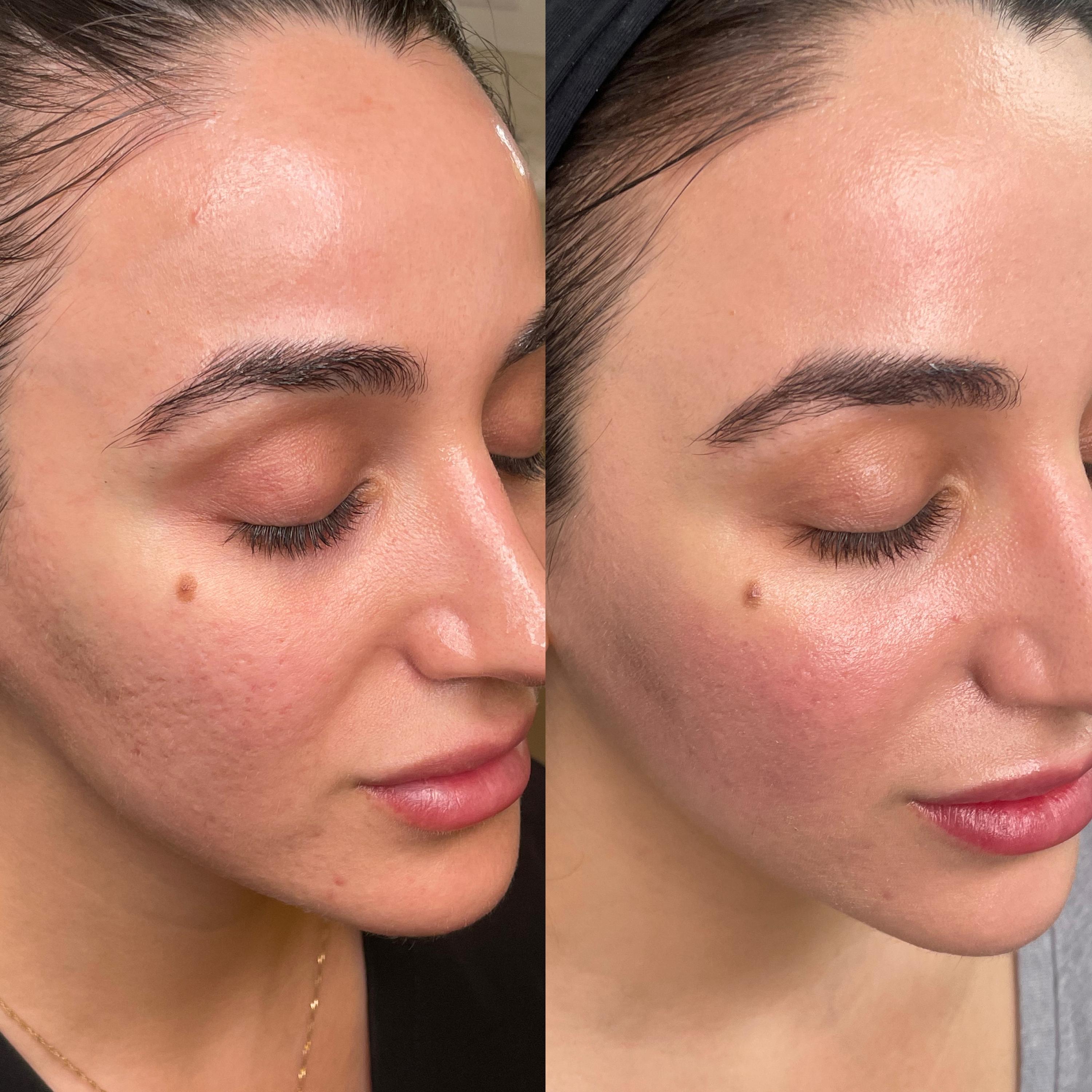 Treatment result photo