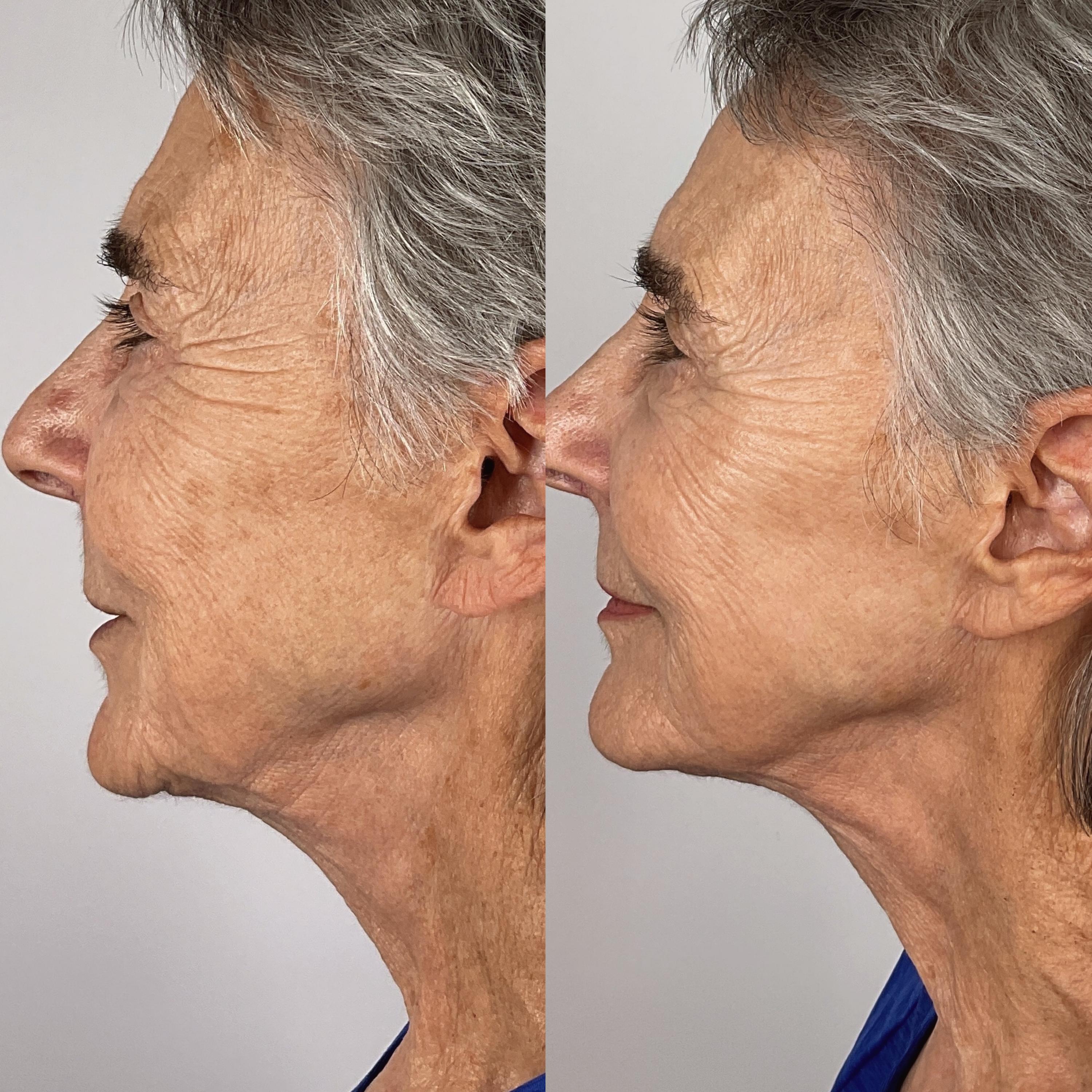 Treatment result photo