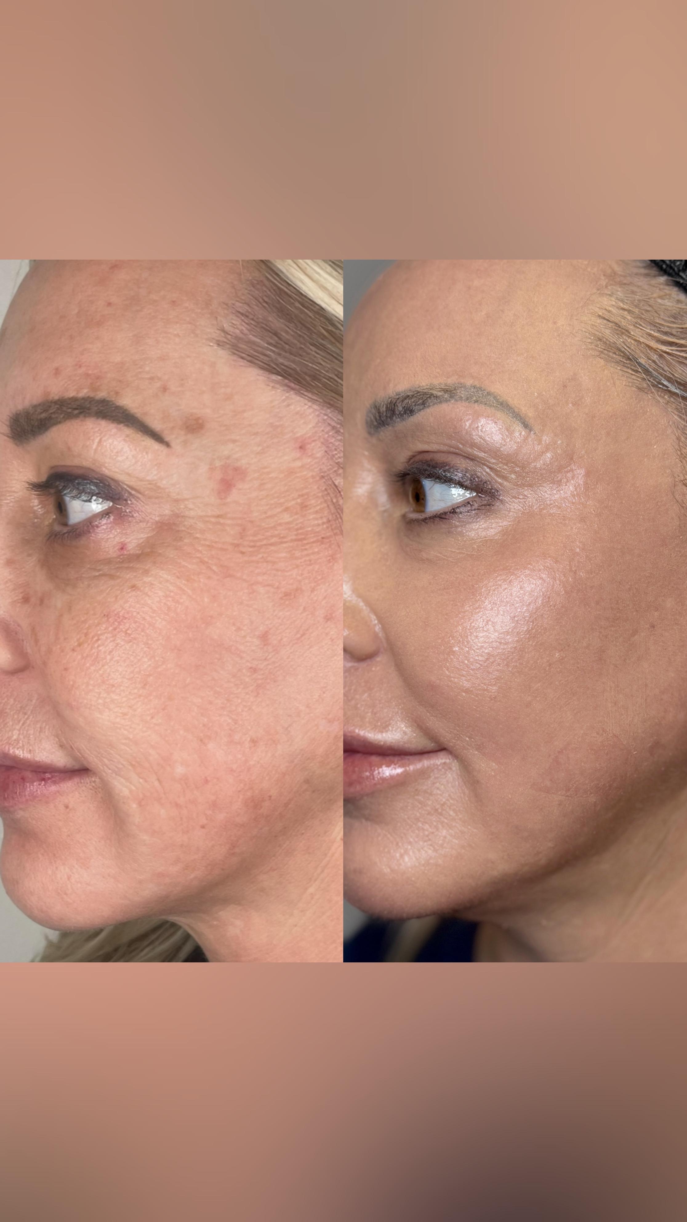Treatment result photo