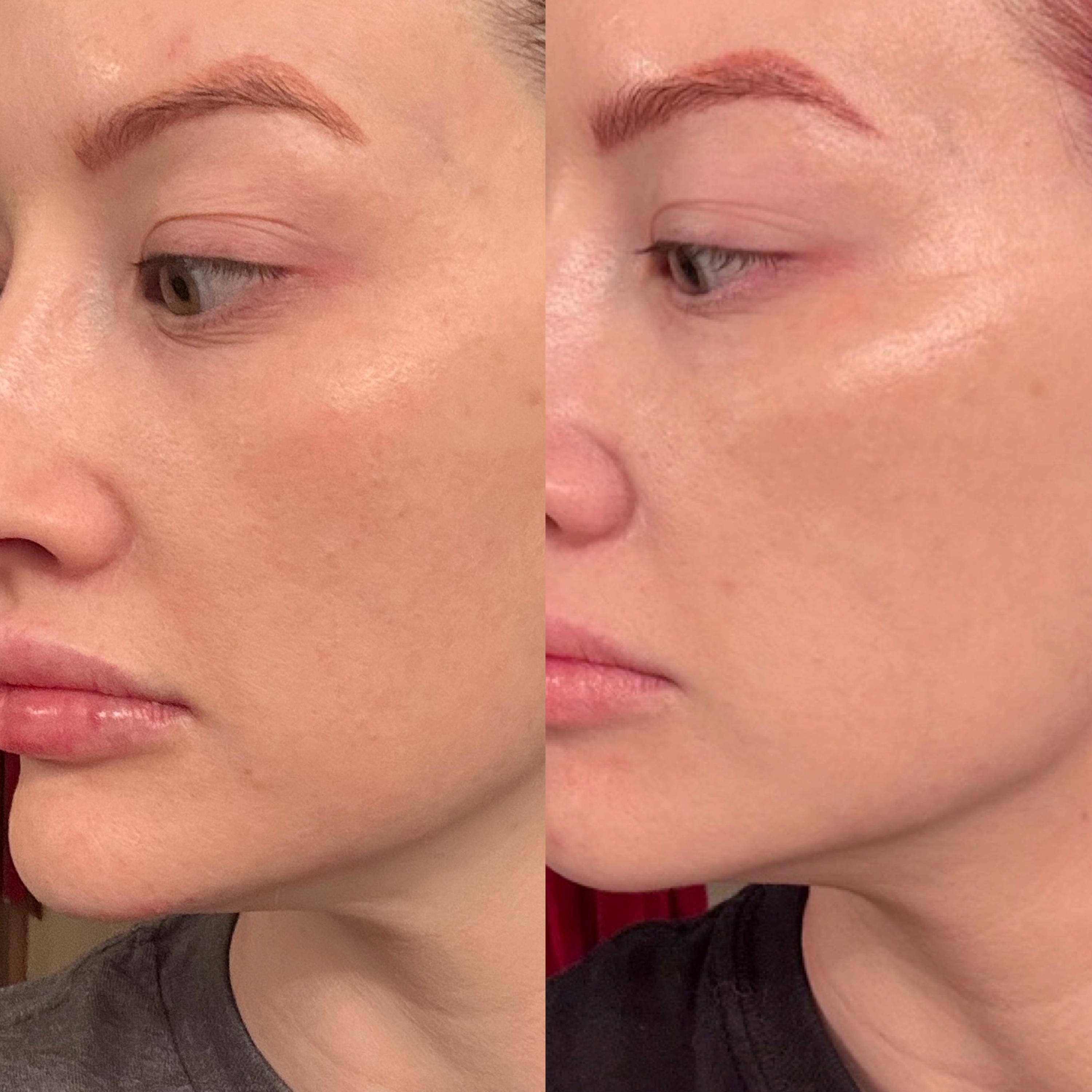 Treatment result photo