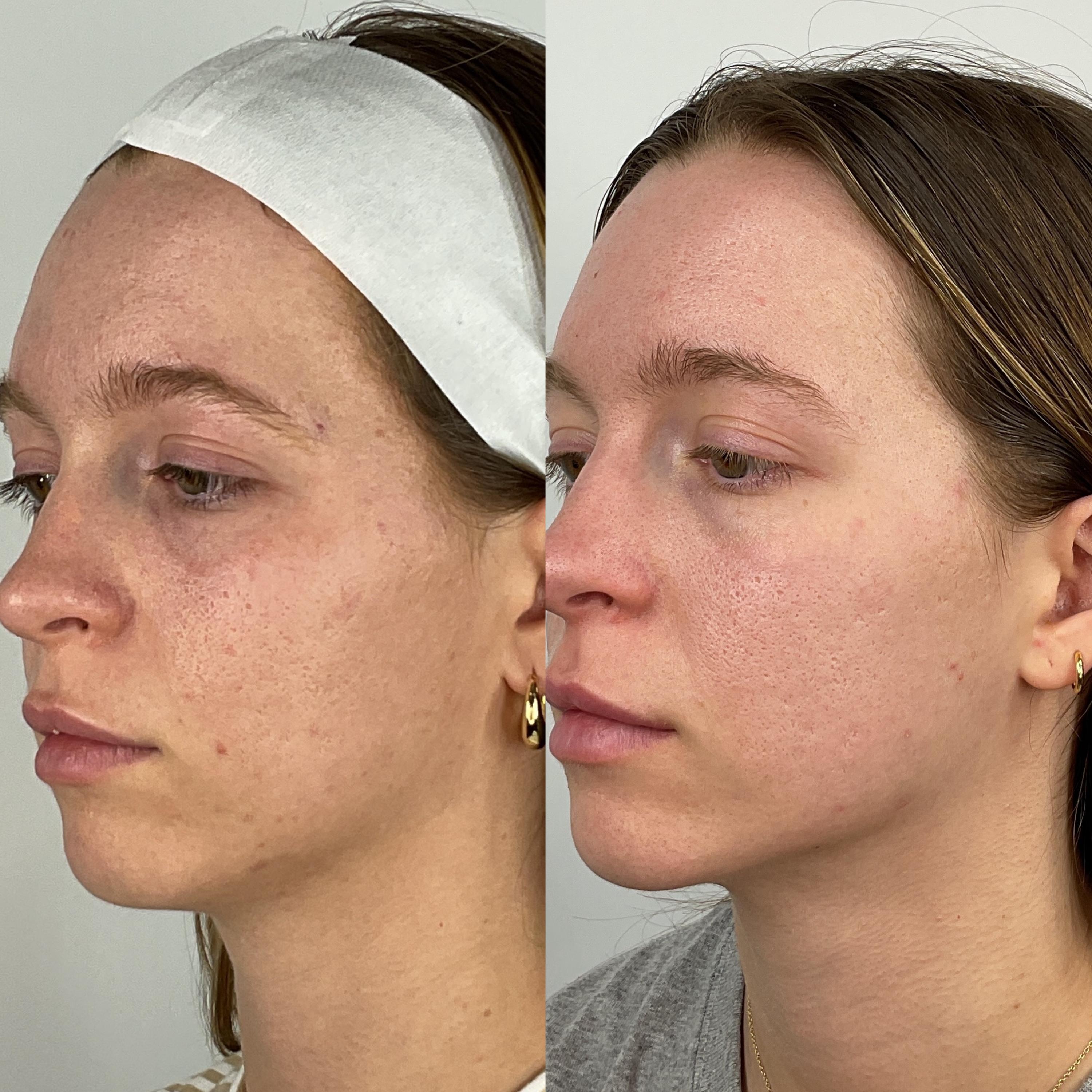 Treatment result photo