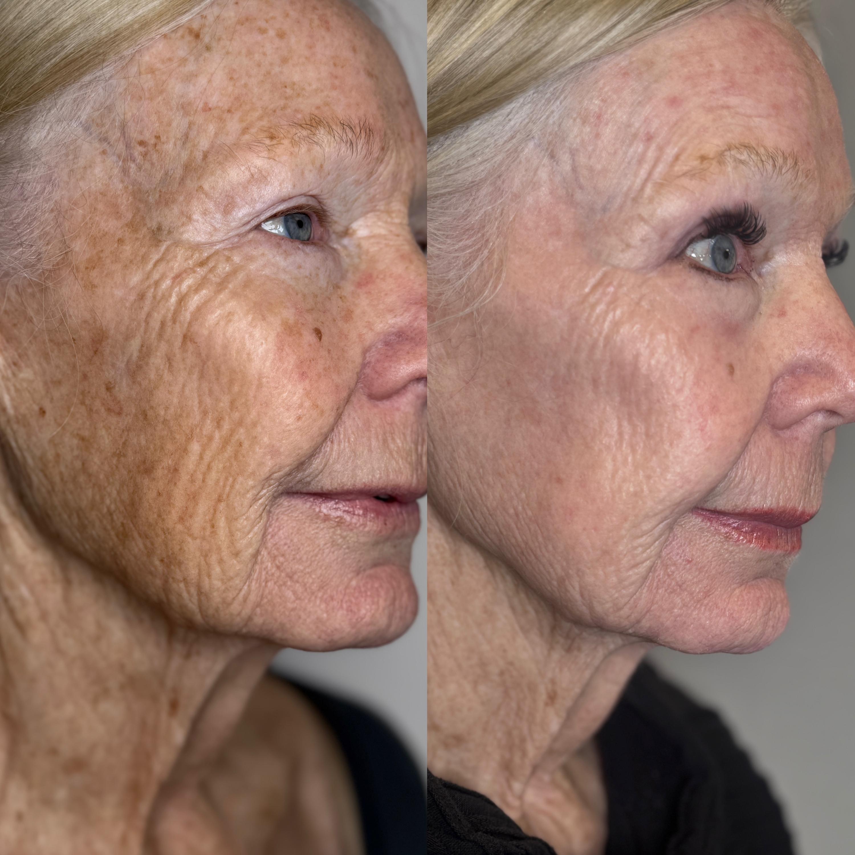 Treatment result photo