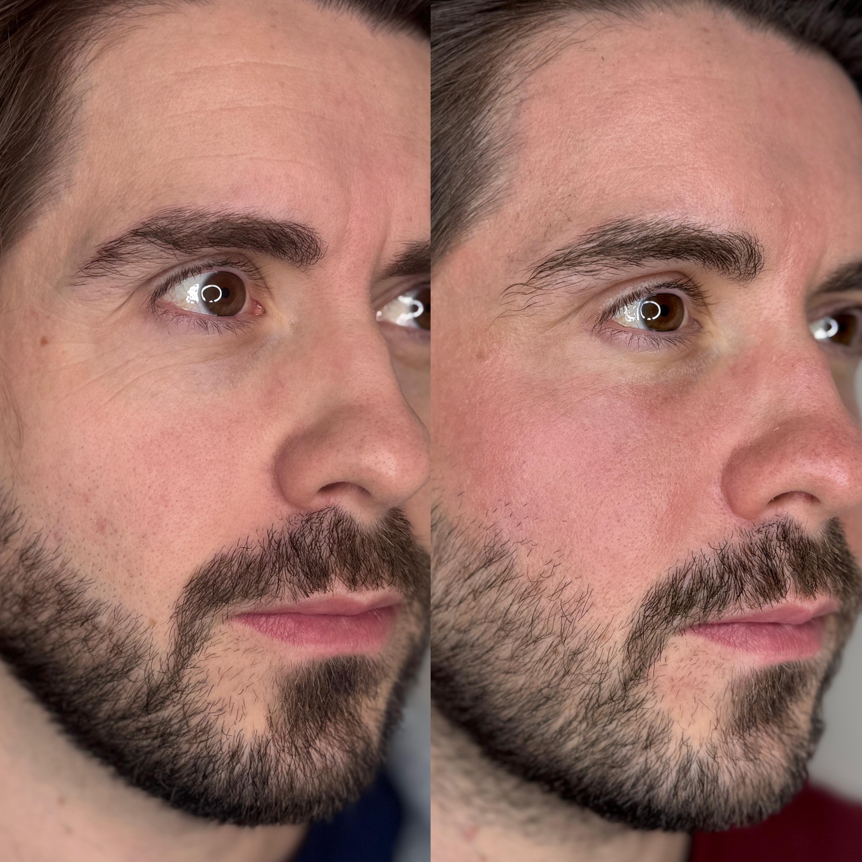 Treatment result photo