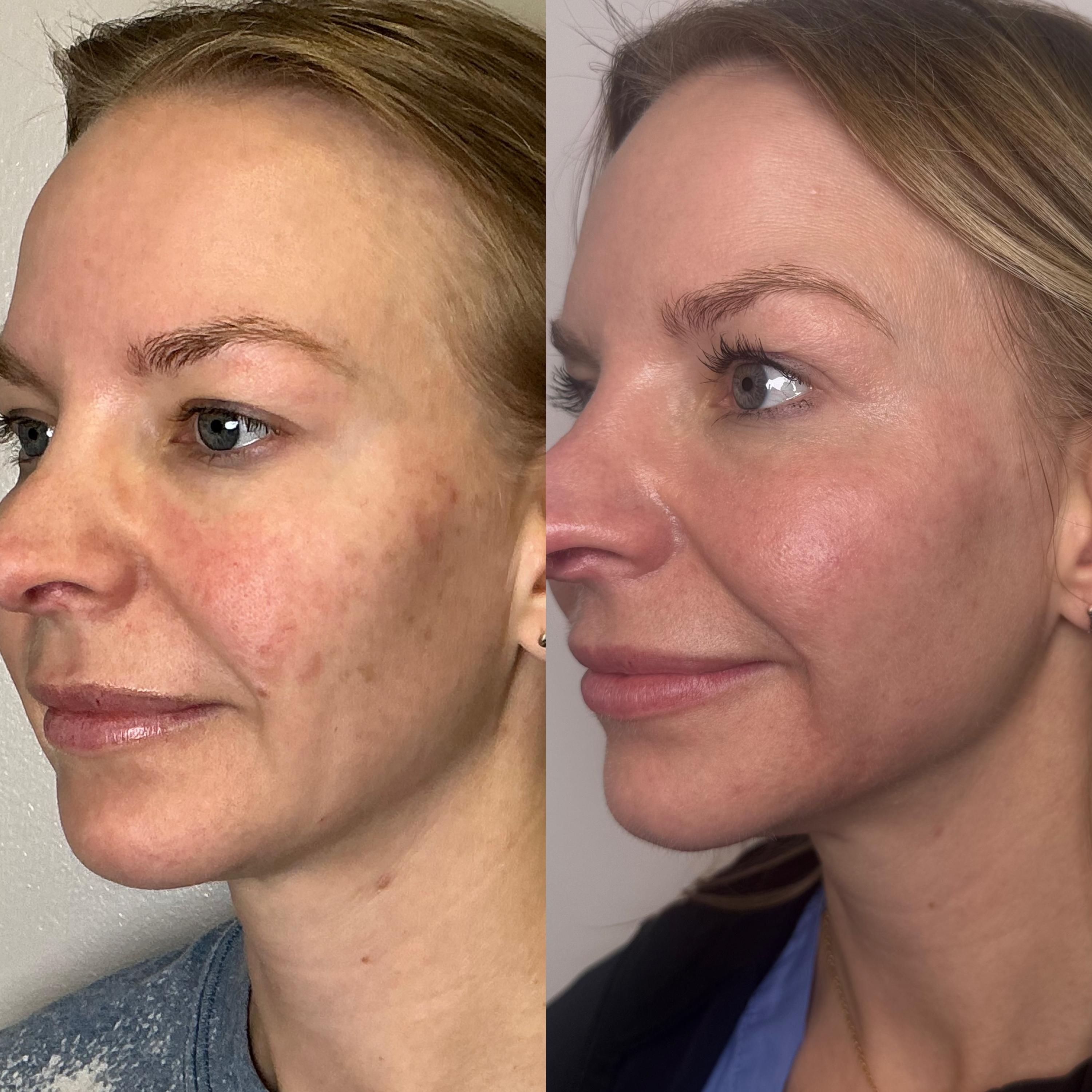 Treatment result photo