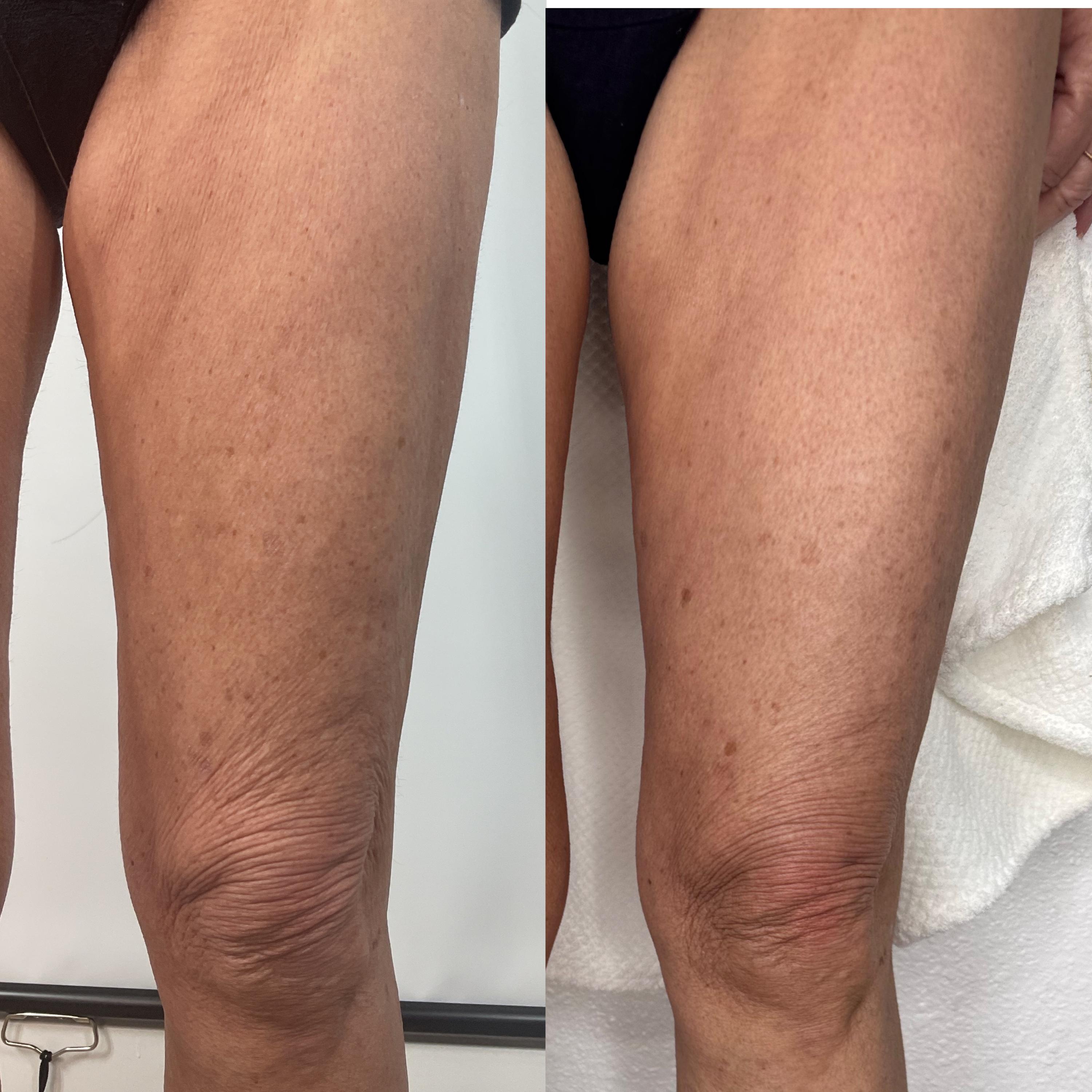 Treatment result photo