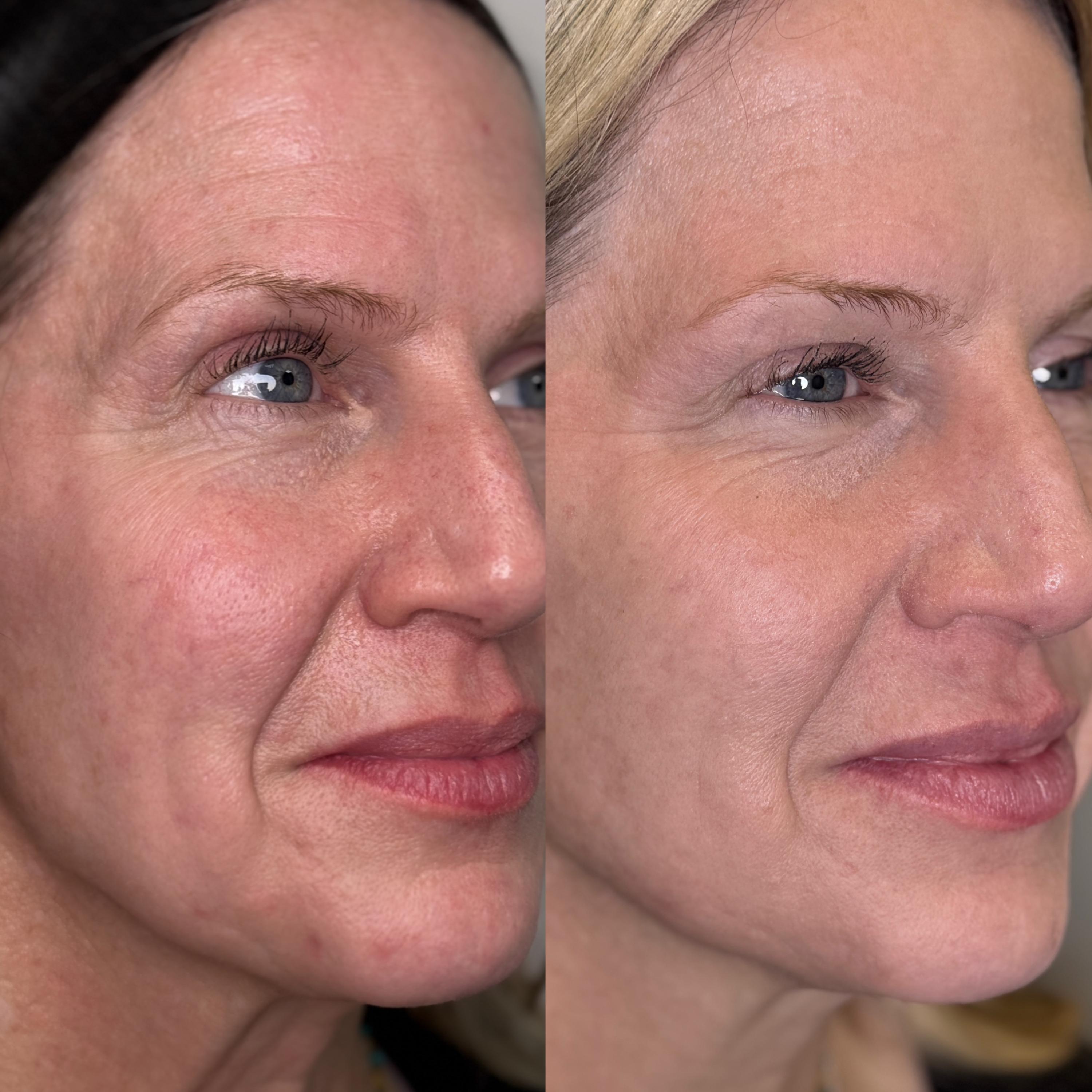 Treatment result photo