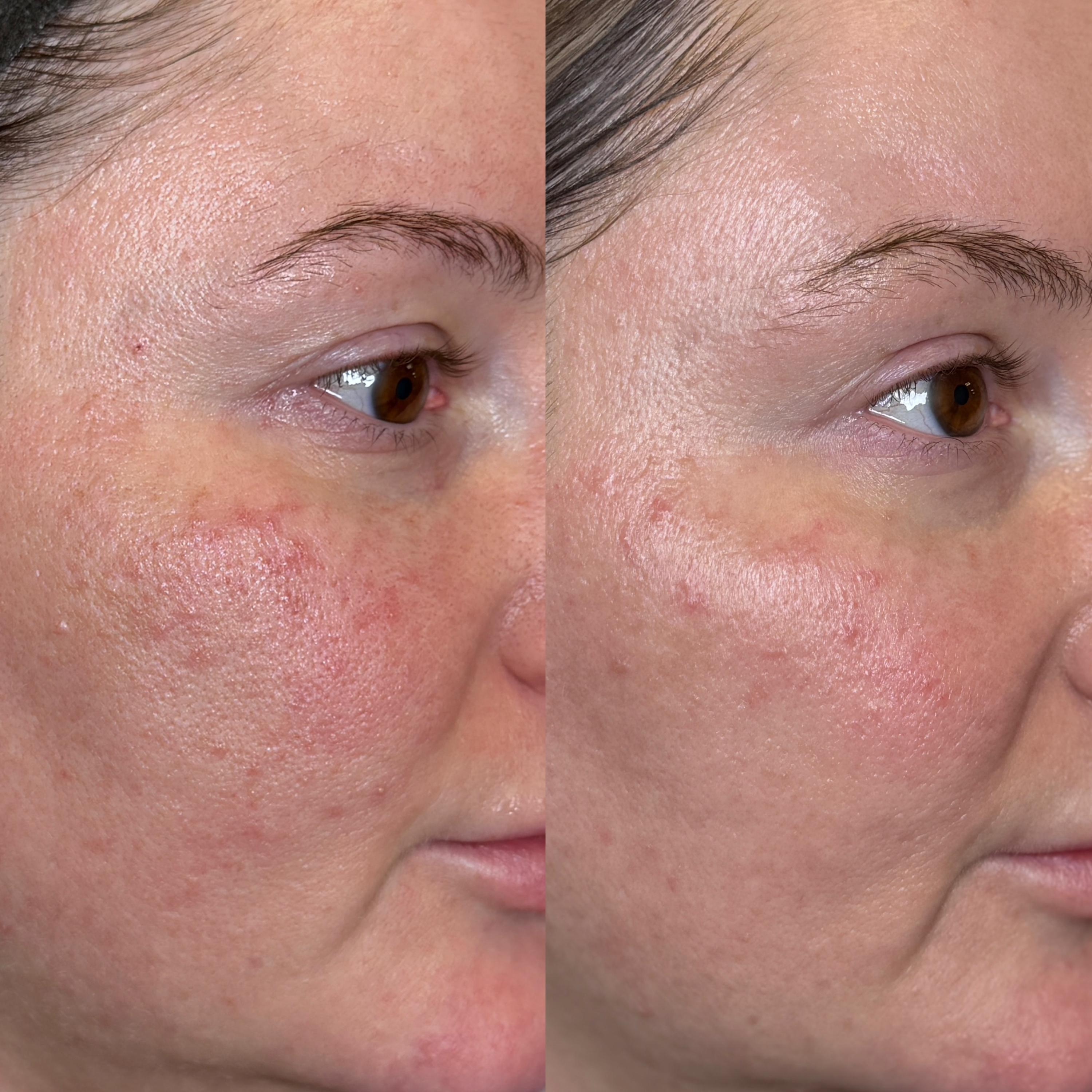 Treatment result photo