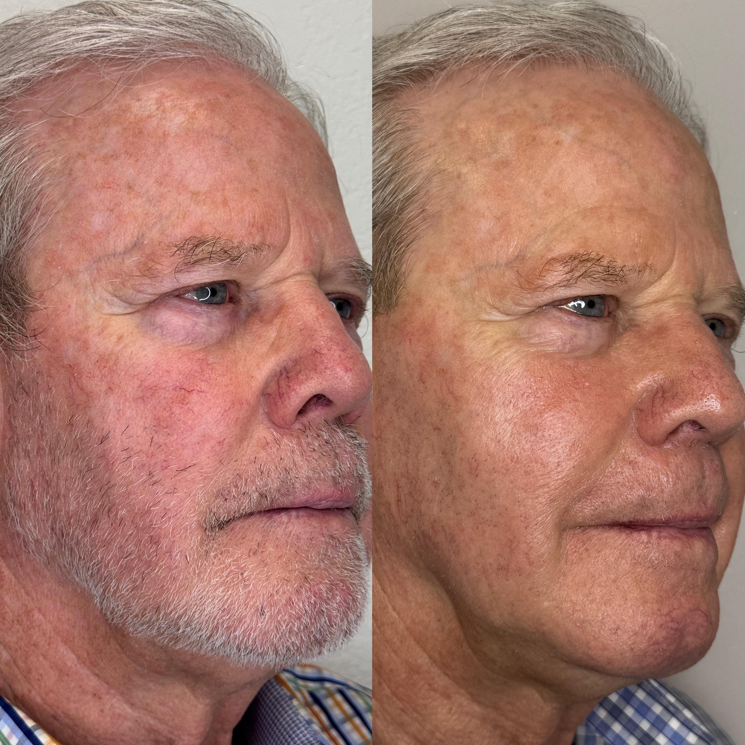Treatment result photo