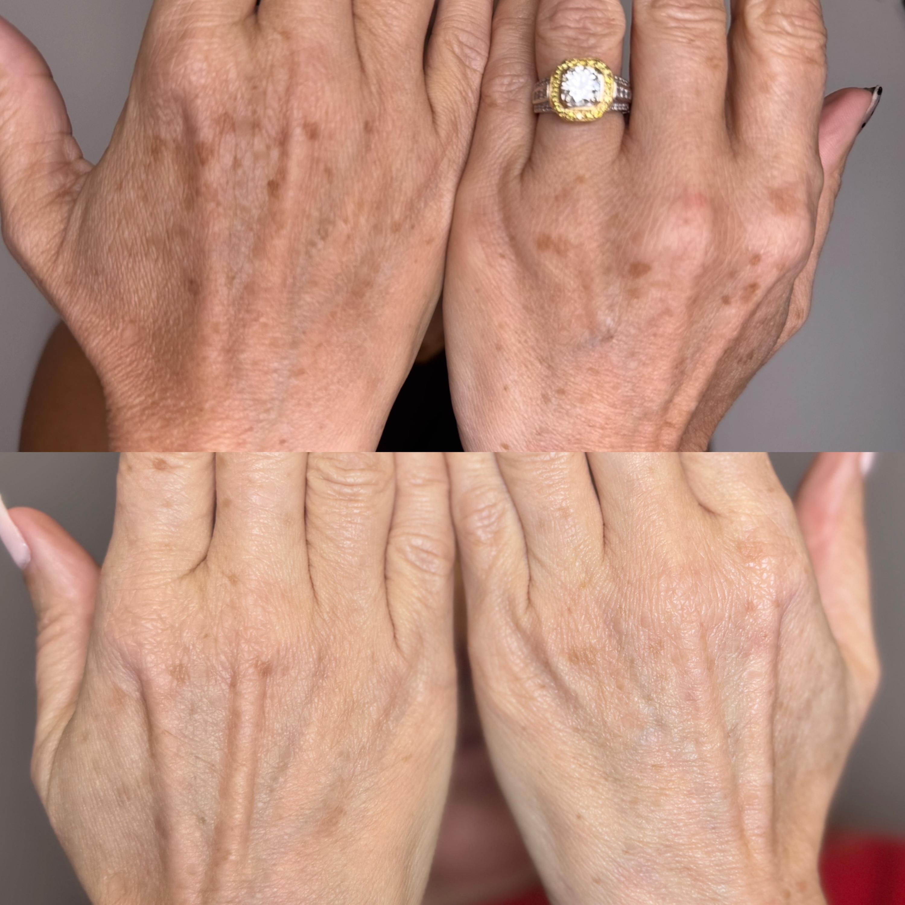 Treatment result photo