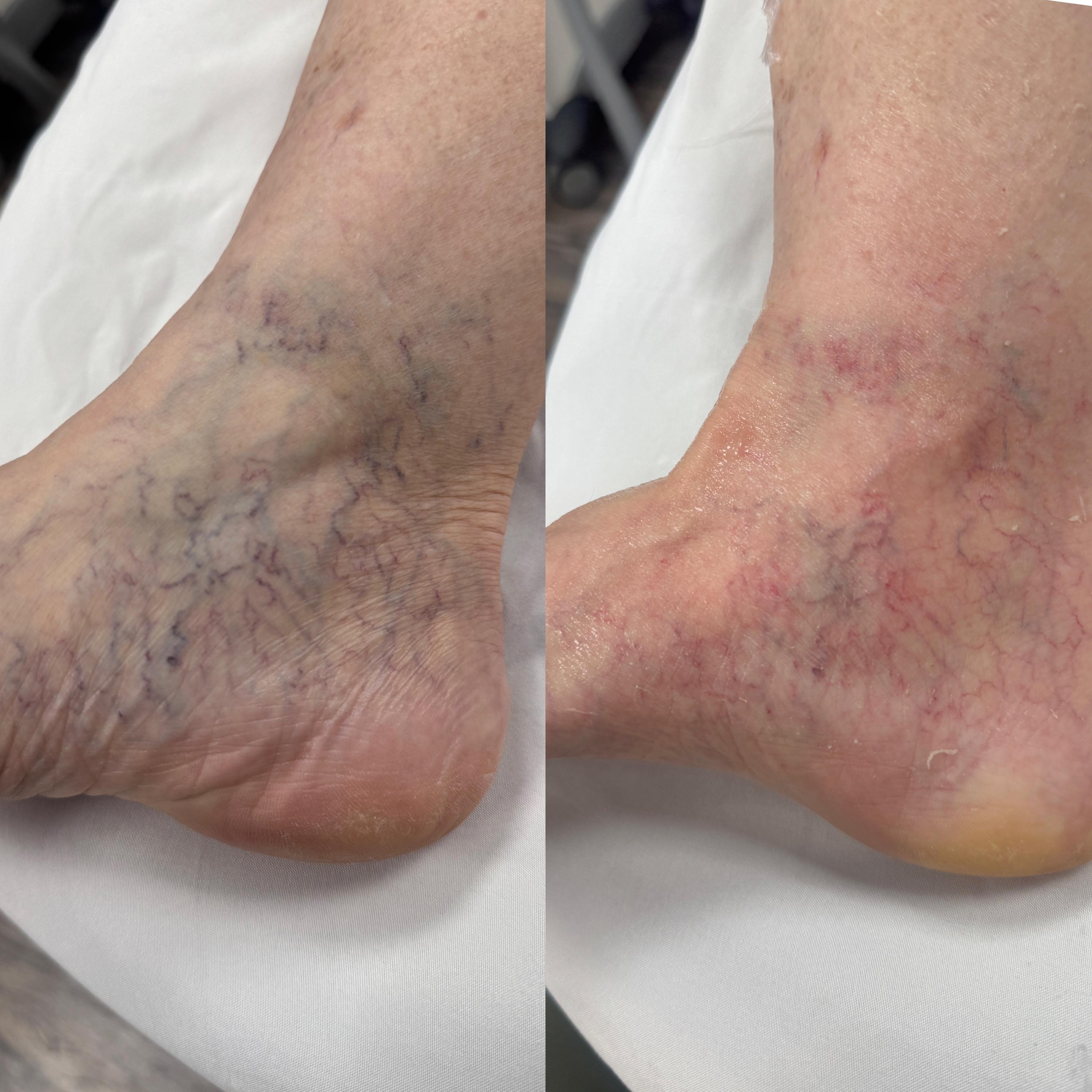 Treatment result photo