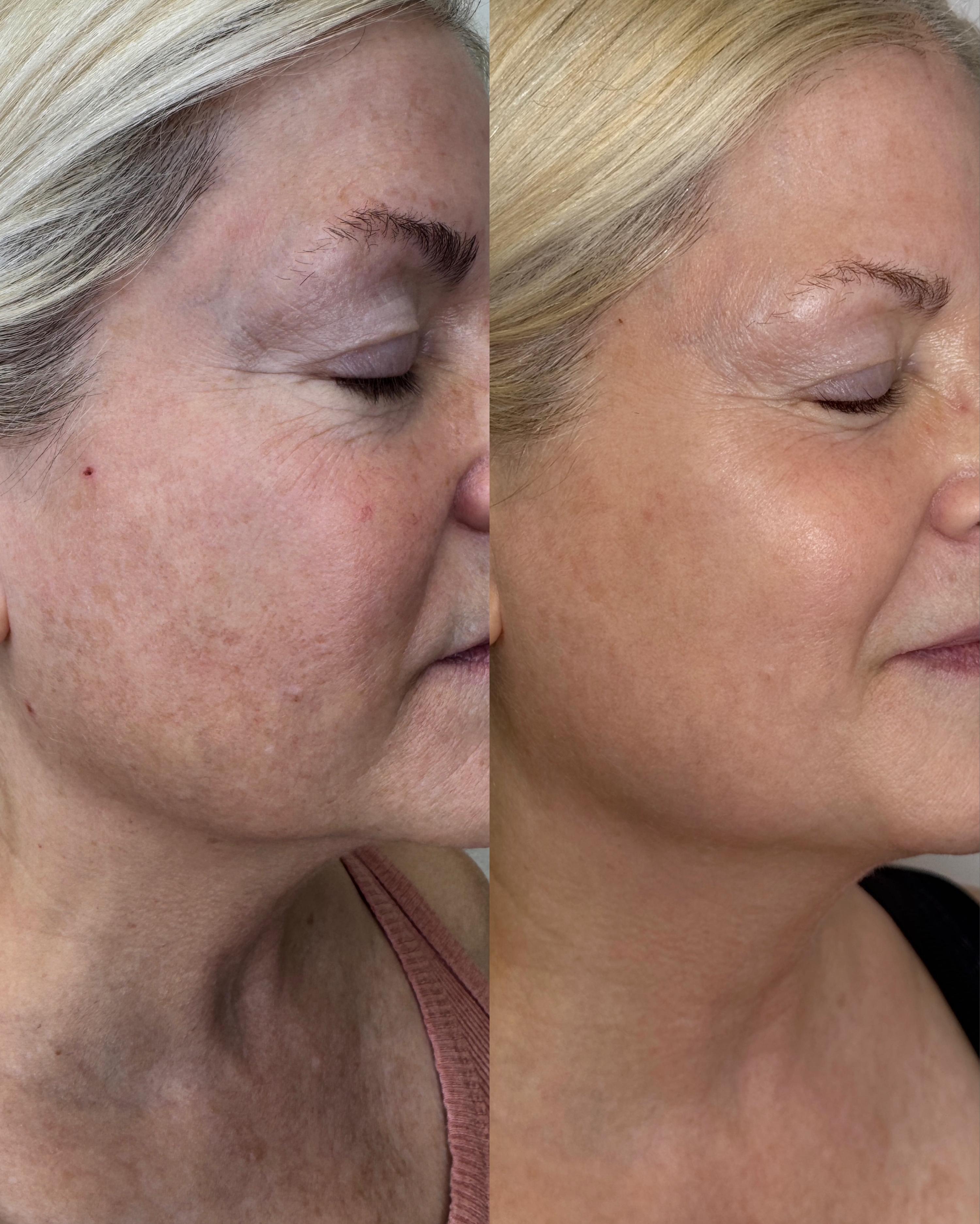Treatment result photo