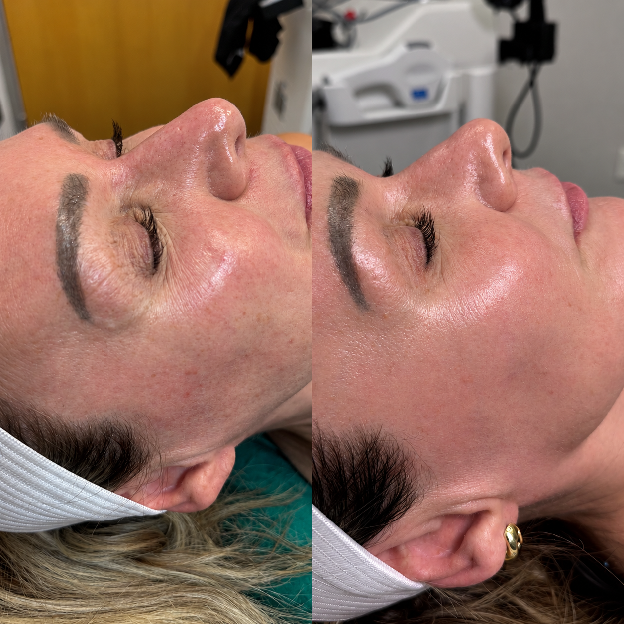 Treatment result photo