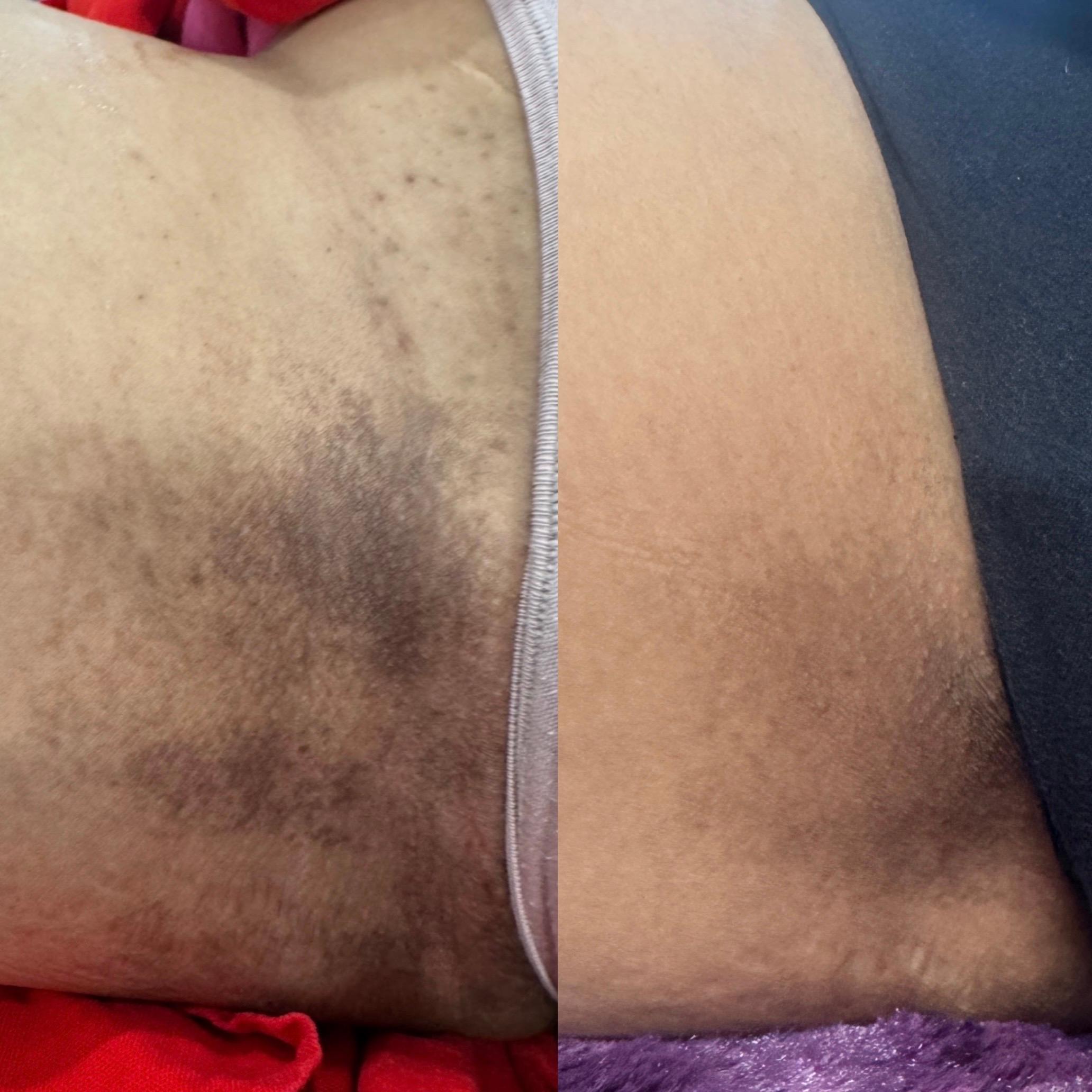 Treatment result photo