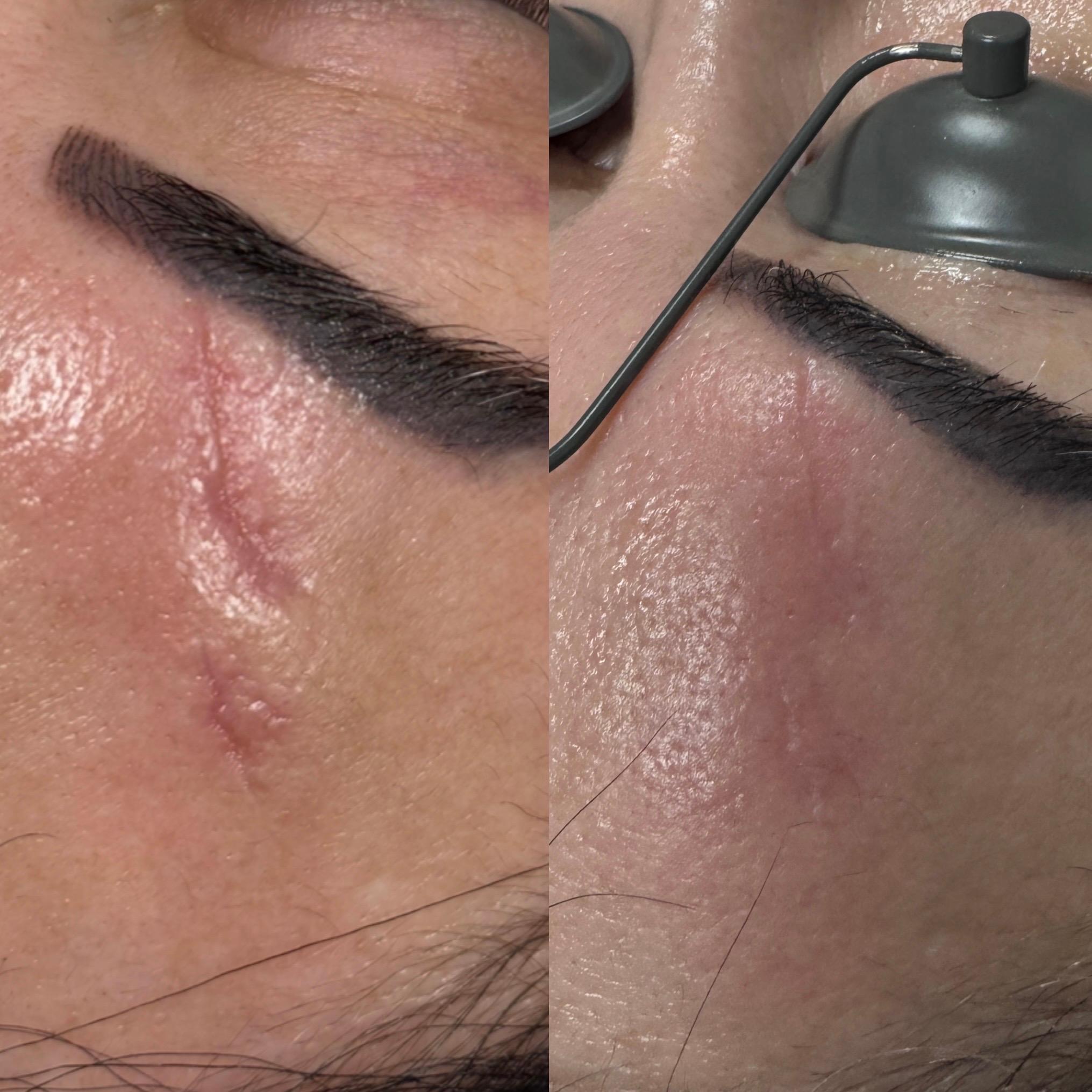 Treatment result photo