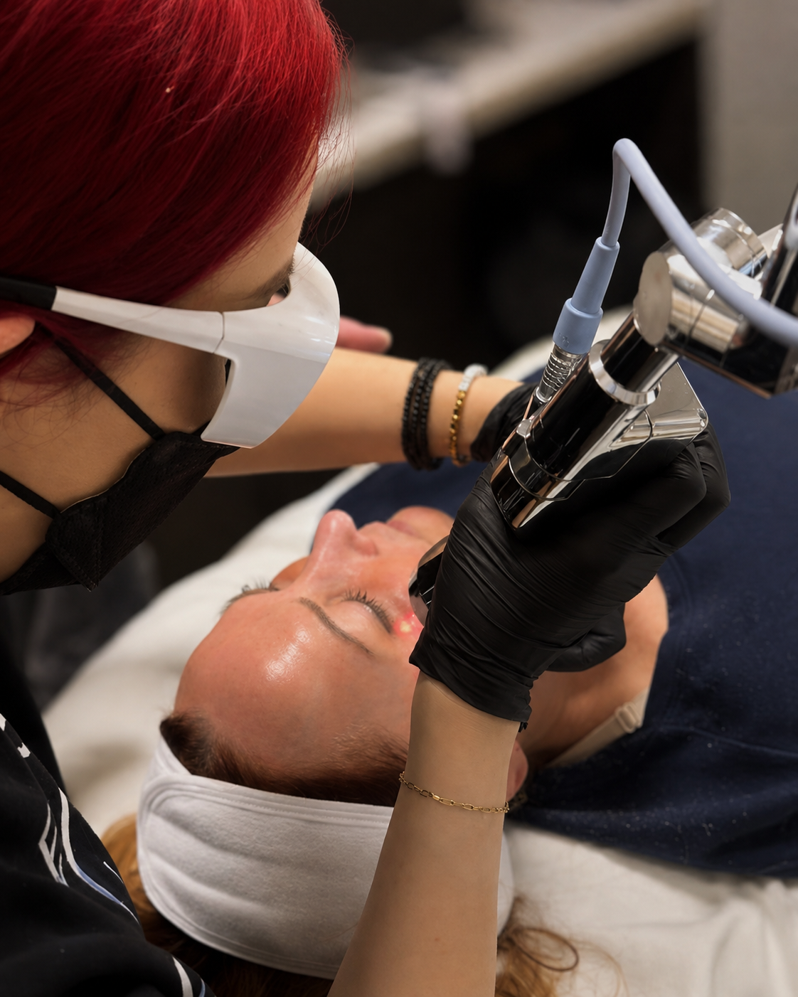 NanoLaserPeel®